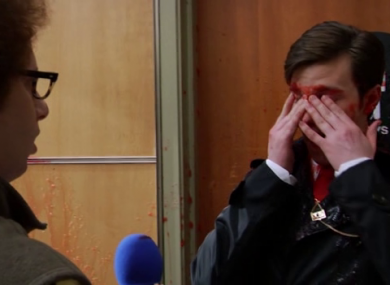 Those 'slushie facials' haven't gone away, you know.