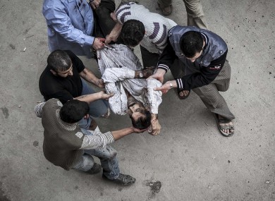 Syrian residents carry a man severely injured from an artillery shell that landed near a bakery, to a hospital for treatment in Aleppo, Syria
