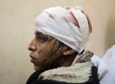 Egyptian Mohammed Ali, 20, is treated at a hospital following a train crash in Badrasheen