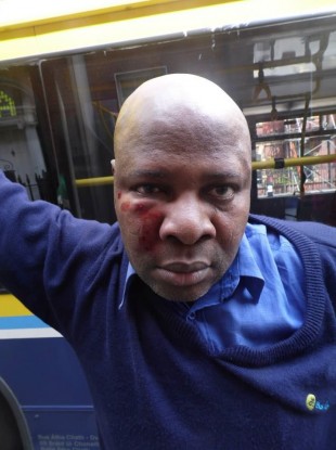 The Dublin Bus driver shortly after the attack.