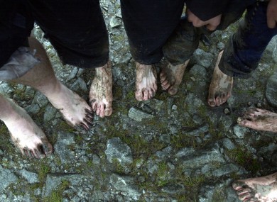 Pilgrims show their feet after climbing Croagh Patrick bare footed