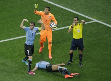 Uruguay's Alvero Pereira was knocked unconscious during a World Cup game against England but was allowed to play on. He later claimed the incident was like 'the lights had gone out'.