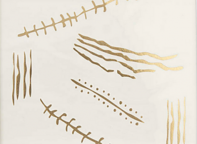 Topshop's transferable scar tattoos, now available to purchase online