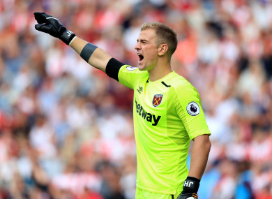 Joe Hart's hopes of featuring for England at the World Cup could be under threat.