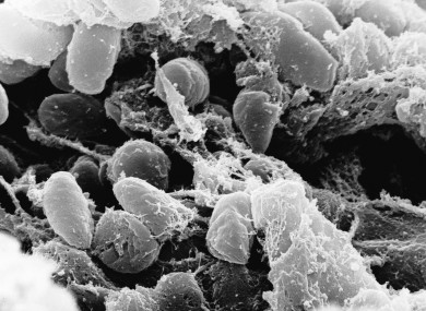 Yersinia pestis bacteria, the cause of the Black Death