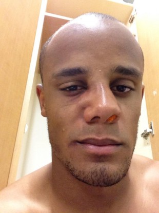The picture that Kompany tweeted today.
