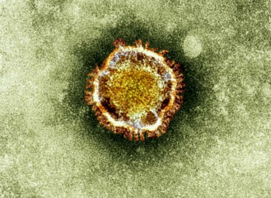 An electron microscope image of a coronavirus.