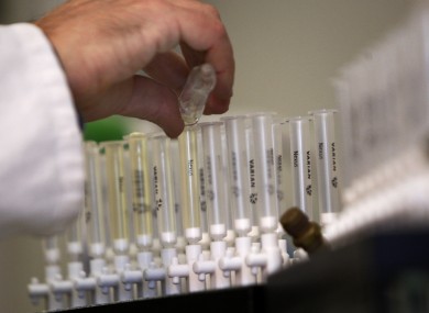 File photo of anti-doping tests.
