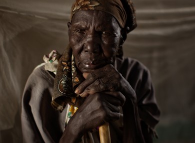 An elderly woman waits to be treated in the Goal clinic in Balliet,a village along the Sobat River in the Greater Upper Nile region of northeastern South Sudan, Africa.