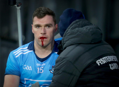 Andrews was left with a bloodied face after the collision.