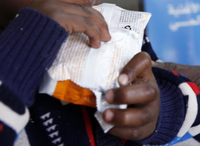 A child given a food packet at a malnutrition ward in Yemen