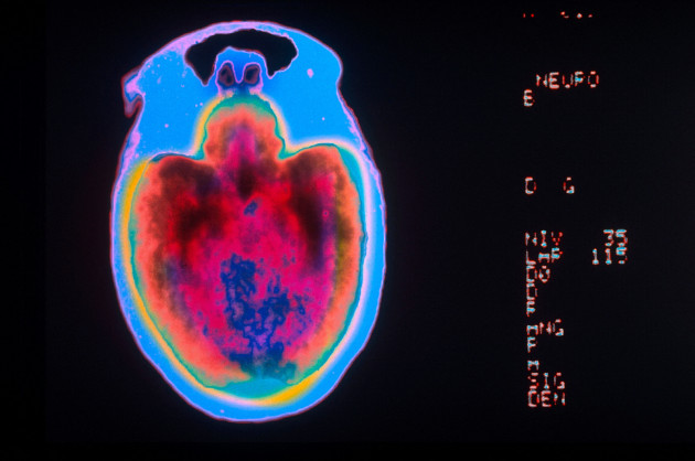 Sorry! Image not available at this time