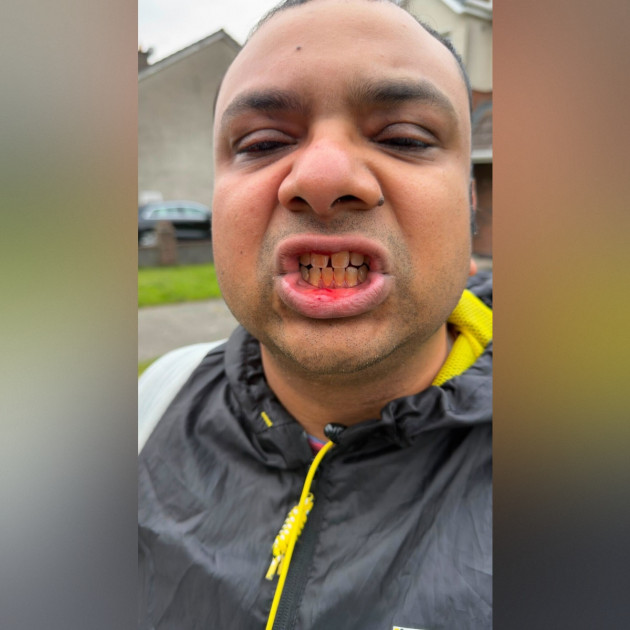 'He's from India': Man allegedly attacked by group of teens after they asked where he was from